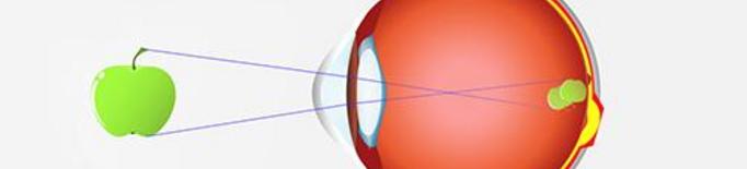 Quins símptomes presenta l'astigmatisme?