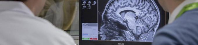 Un estudi neurocientífic millora el diagnòstic i tractament de l'Alzheimer