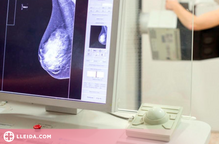 ⏯️ Demostren que un fàrmac frena el càncer de mama en el 75,8% de les pacients