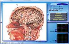 Estudio de neurotransmisores, hormonas, enzimas,química cerebral.Dra.Arnold