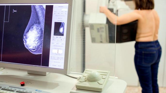 Detectats de manera precoç 51 càncers de mama a Lleida