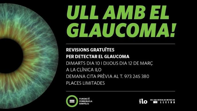Revisions gratuïtes per detectar el glaucoma amb la Fundació Ferreruela Sanfeliu