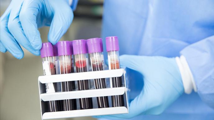 Una empresa catalana permet optimitzar el rendiment físic i la salut amb una mostra de sang