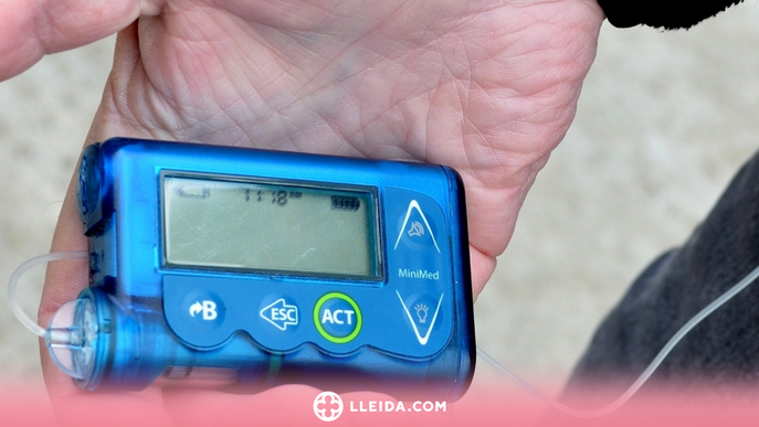 Dia Mundial de la Diabetis: Tot el que has de saber sobre les bombes d'insulina