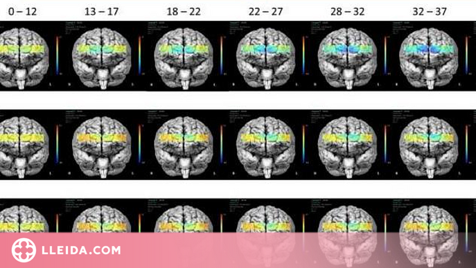 Dos circuits neuronals indiquen l'eficàcia de la teràpia psicològica en pacients amb ansietat 
