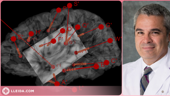 L'estimulació d'una part del cervell fa variar l'activitat del cor