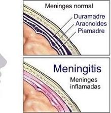 Pateixo pel meu fill davant el cas mortal de meningitis. Alguna recomanació?