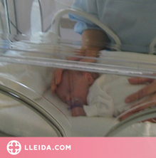 Quines complicacions pot tenir un nadó prematur?