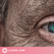 Quins són els símptomes de les cataractes?