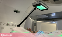 Un hospital català incorpora la intel·ligència artificial per planificar la radioteràpia al cervell