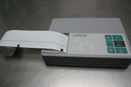Electrocardiogrames