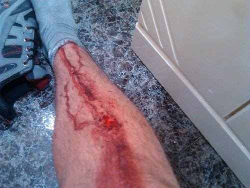 Un menor denuncia una agressió de la Urbana i aquesta ho desmenteix