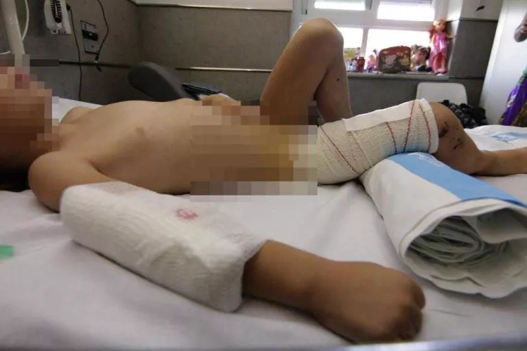 La nena estava ahir ingressada a l’hospital set dies després del brutal atac.