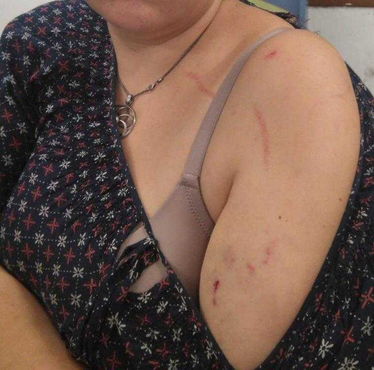 Presumpta agressió per llaços grocs a Torrefarrera