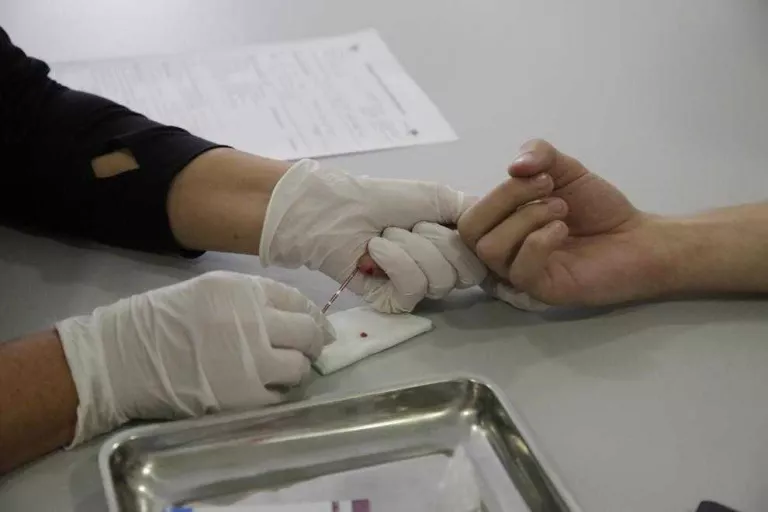 Vora 115 proves del VIH entre els universitaris de Lleida