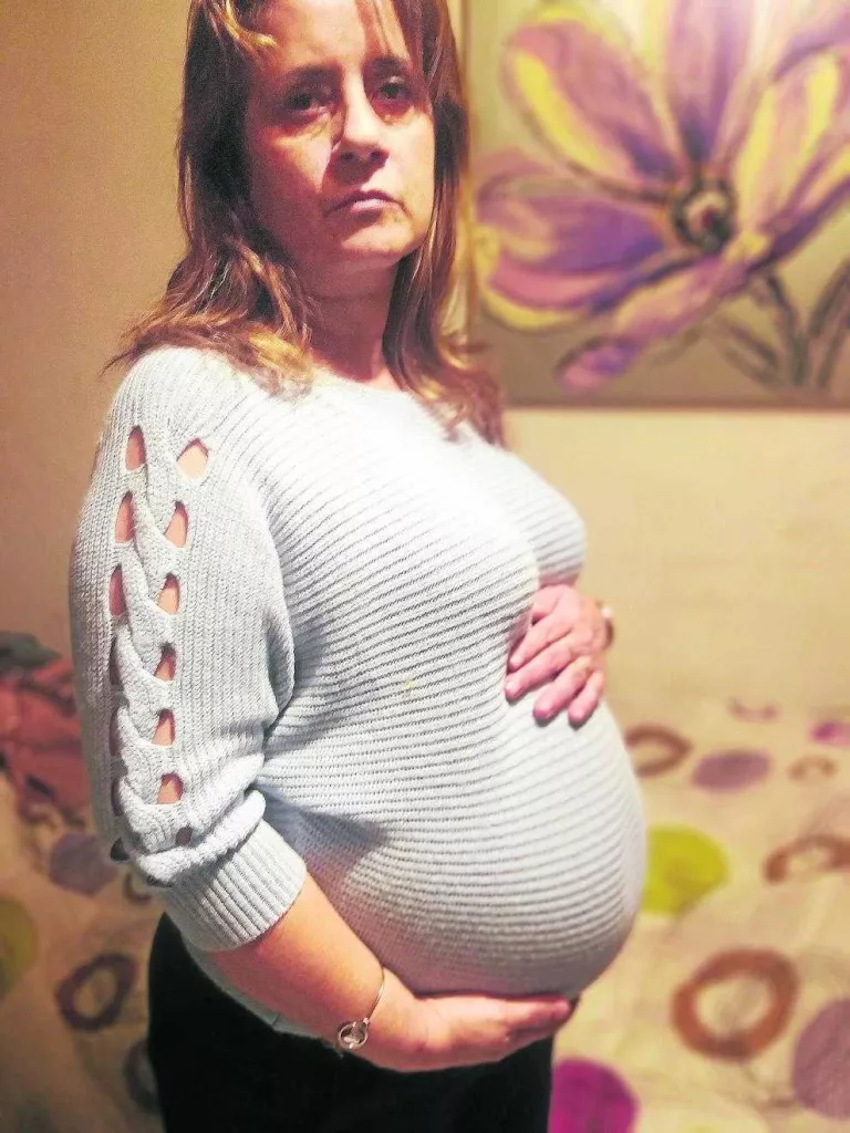 Ajornen de nou extirpar la vesícula a la dona que porta 15 mesos d'espera