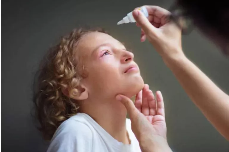 Conjuntivitis Vírica: prevenció i cura durant l’hivern