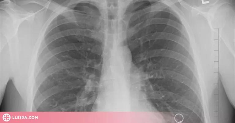 El Parlament aprova que s'incorpori el servei de radiologia al CAP de les Borges Blanques
