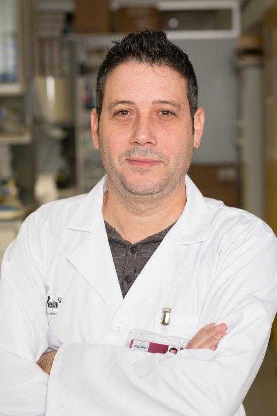 Un estudi lleidatà demostra l'efecte protector d'una proteïna per reduir la progressió de la fibrosi dels ronyons