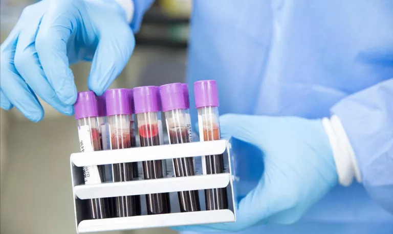 Una empresa catalana permet optimitzar el rendiment físic i la salut amb una mostra de sang