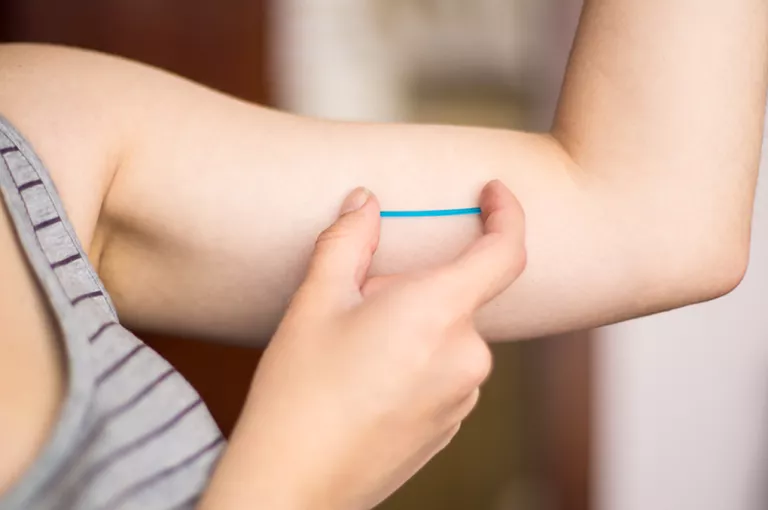 Què és i com funciona un implant anticonceptiu?