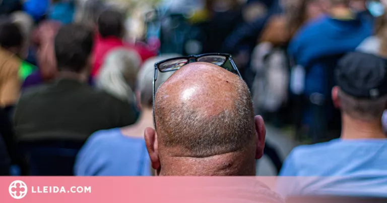 Quines són les causes de l'alopècia?