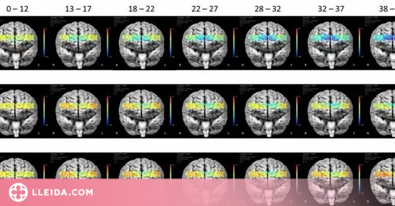 Dos circuits neuronals indiquen l'eficàcia de la teràpia psicològica en pacients amb ansietat