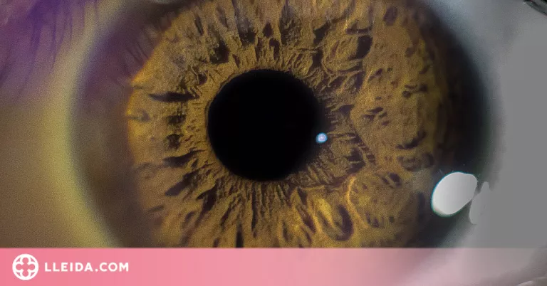 Retinopatia diabètica: definició, causes i tractament