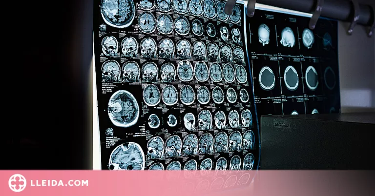 L'Estimulació cerebral no invasiva, una teràpia alternativa per tractar el Trastorn Bipolar