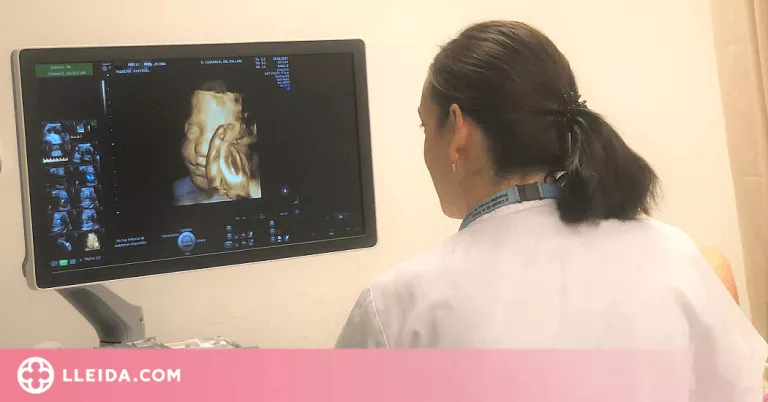 L'Hospital del Pallars incorpora dos ecògrafs d'alta resolució per ginecologia i obstetrícia