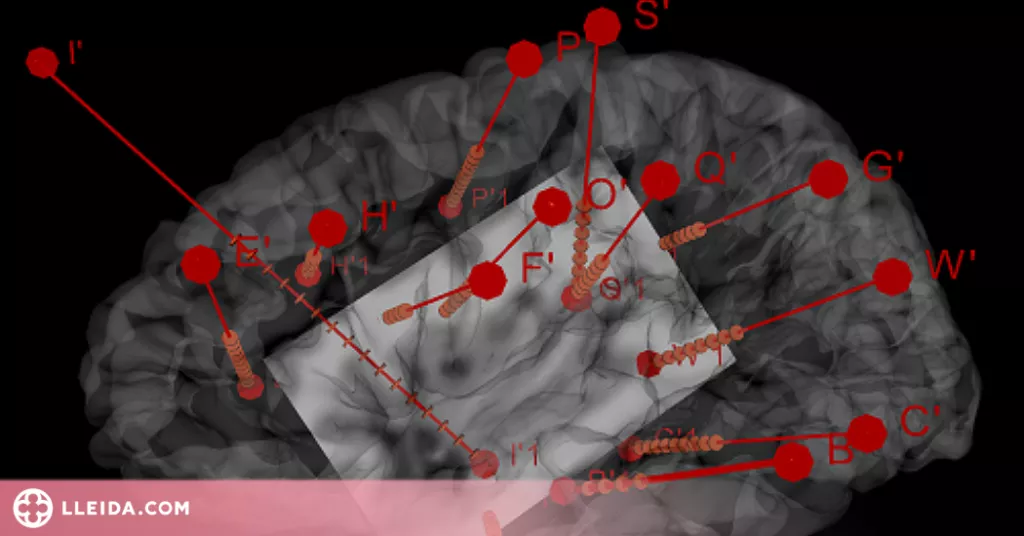 L'estimulació d'una part del cervell fa variar l'activitat del cor