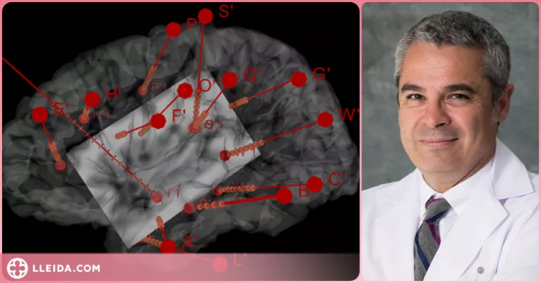 L'estimulació d'una part del cervell fa variar l'activitat del cor