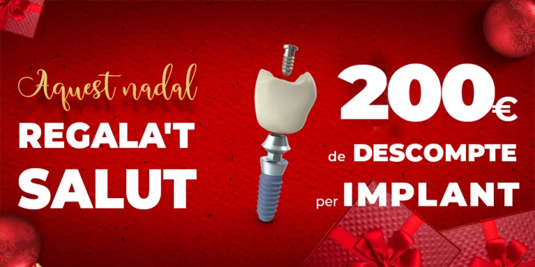 200€ de DESCOMPTE per IMPLANT dental